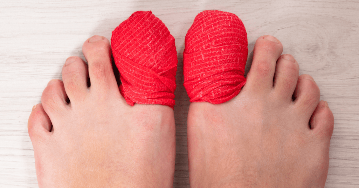 why-do-runners-lose-toenails-plus-3-preventative-actions-fitter-habits